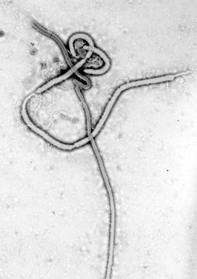 El virus del ébola visto al microscopio electrónico.